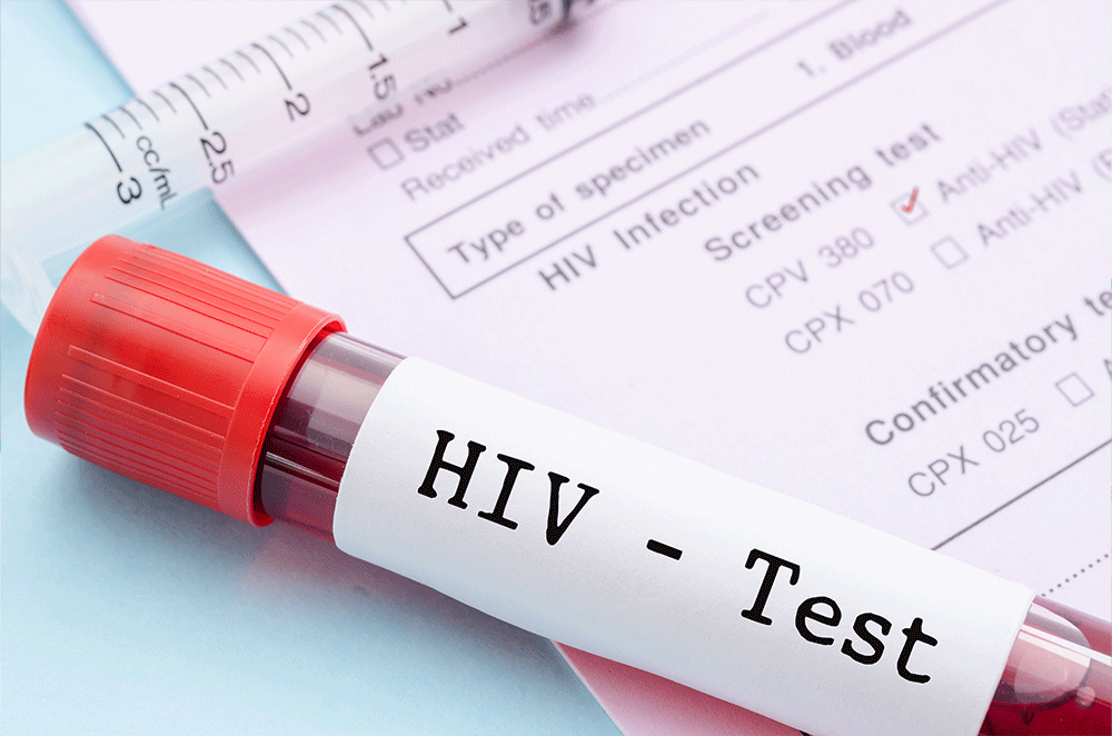 HIV Test vial laying on test form