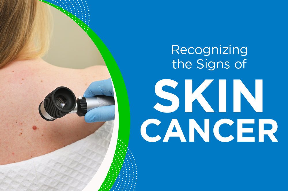 Recognizing the Signs of Skin Cancer
