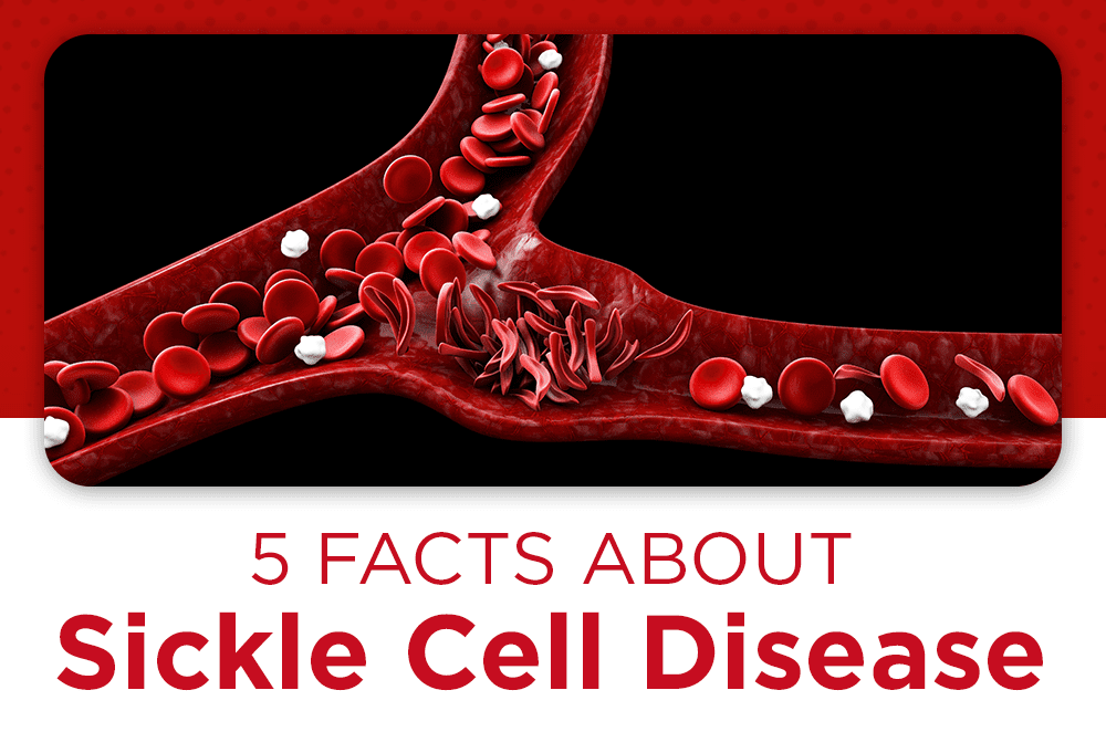 photo of sickle cell disease