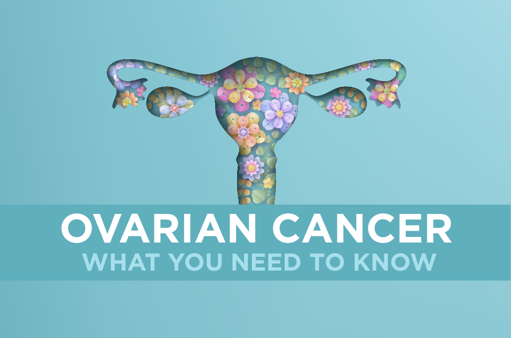 Ovarian Cancer: What You Need to Know