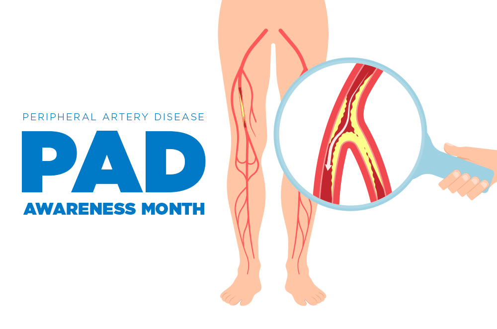Peripheral Artery Disease PAD Awareness Month